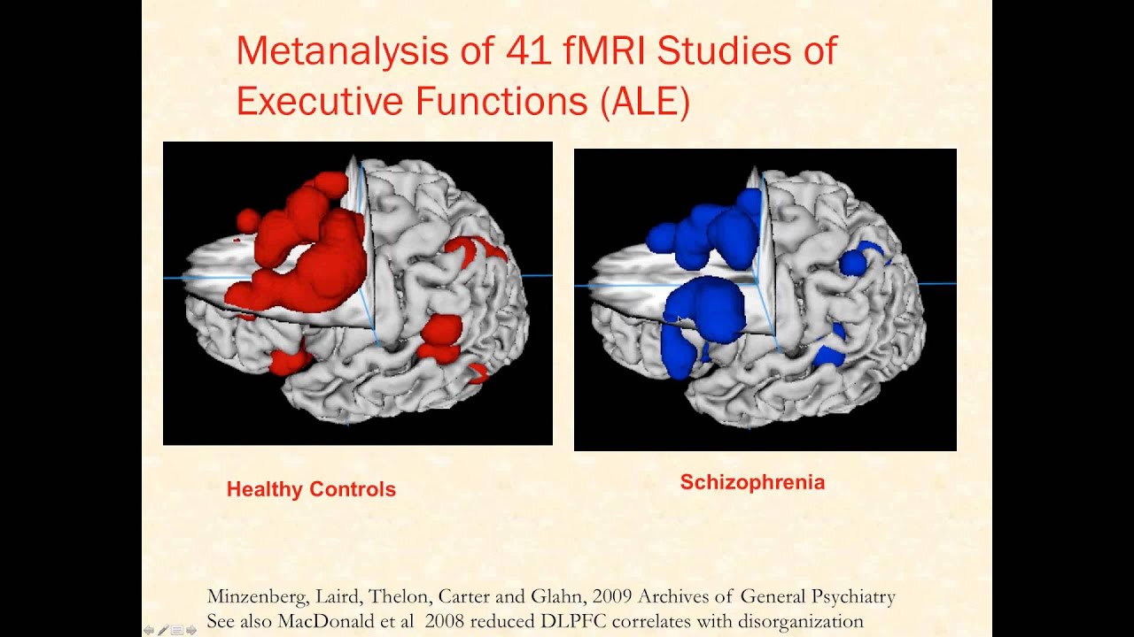 Brain Networks in Schizophrenia and Bipolar Disorder: Targets for Novel Therapies
