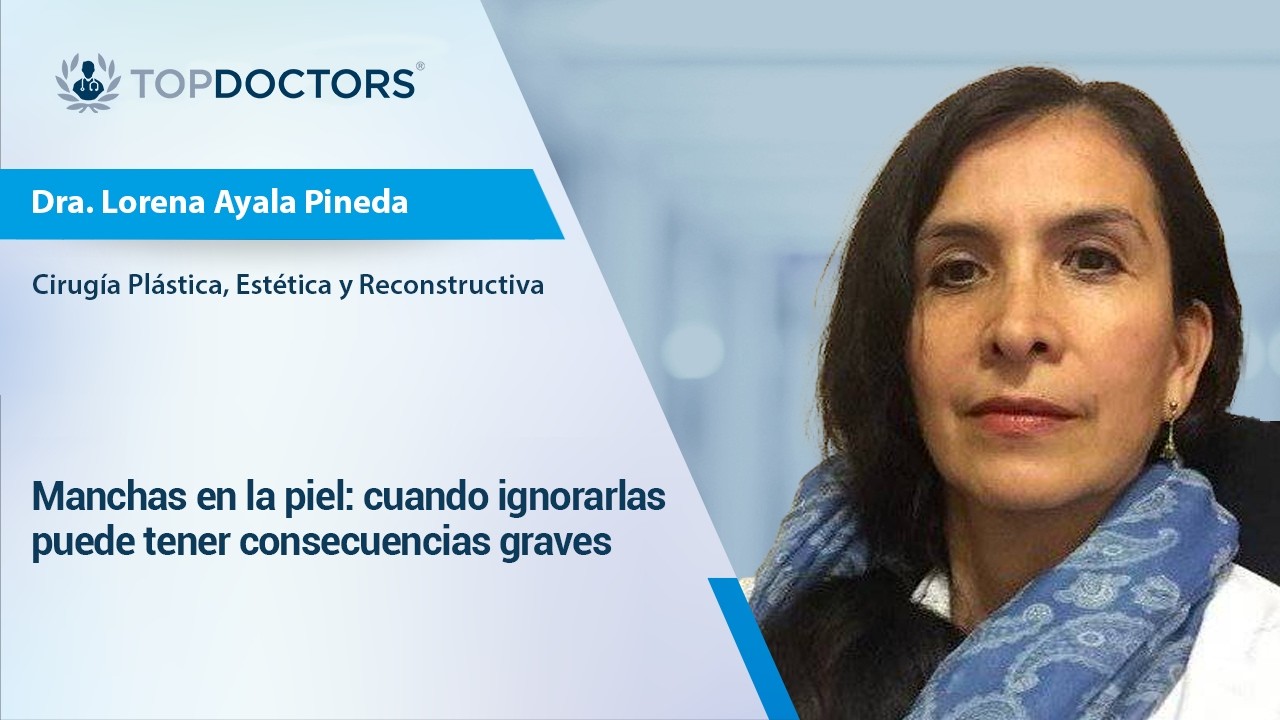 Manchas en la piel: cuando ignorarlas puede tener consecuencias graves