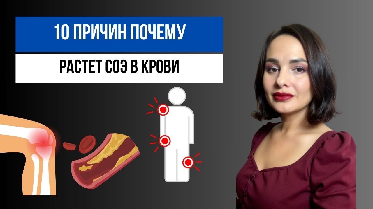 10 причин повышения СОЭ. Скорость оседания эритроцитов, что за анализ