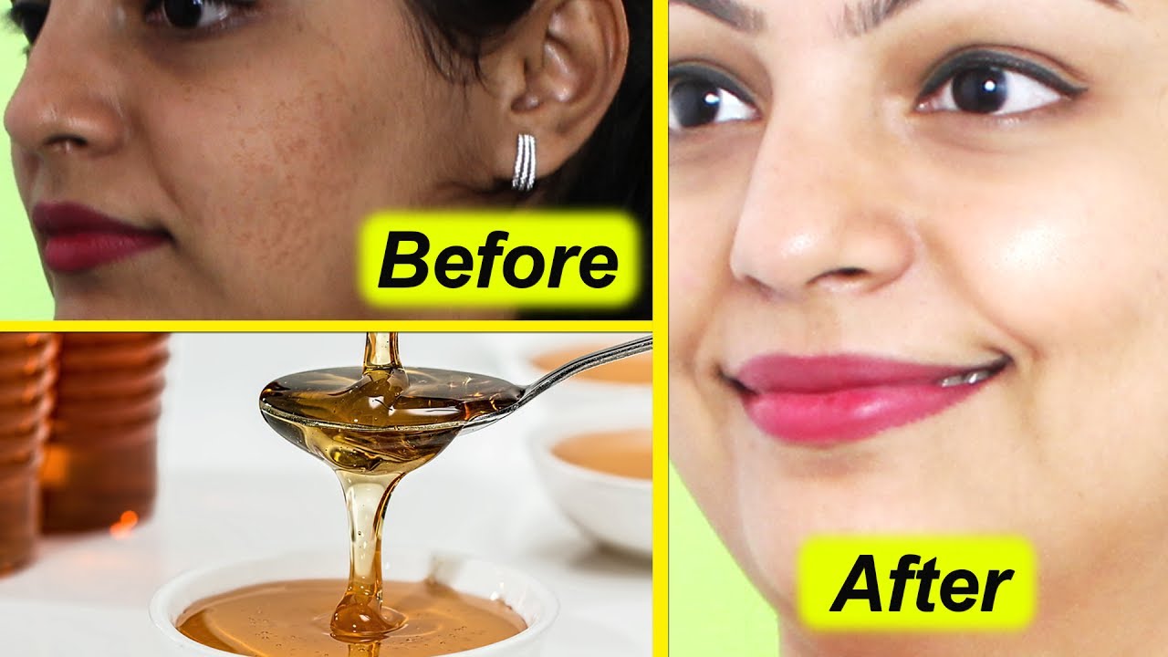 शहद से पाए गोरी और निखरी त्वचा || Beauty Tips of Honey || Get Fair Glowing Skin