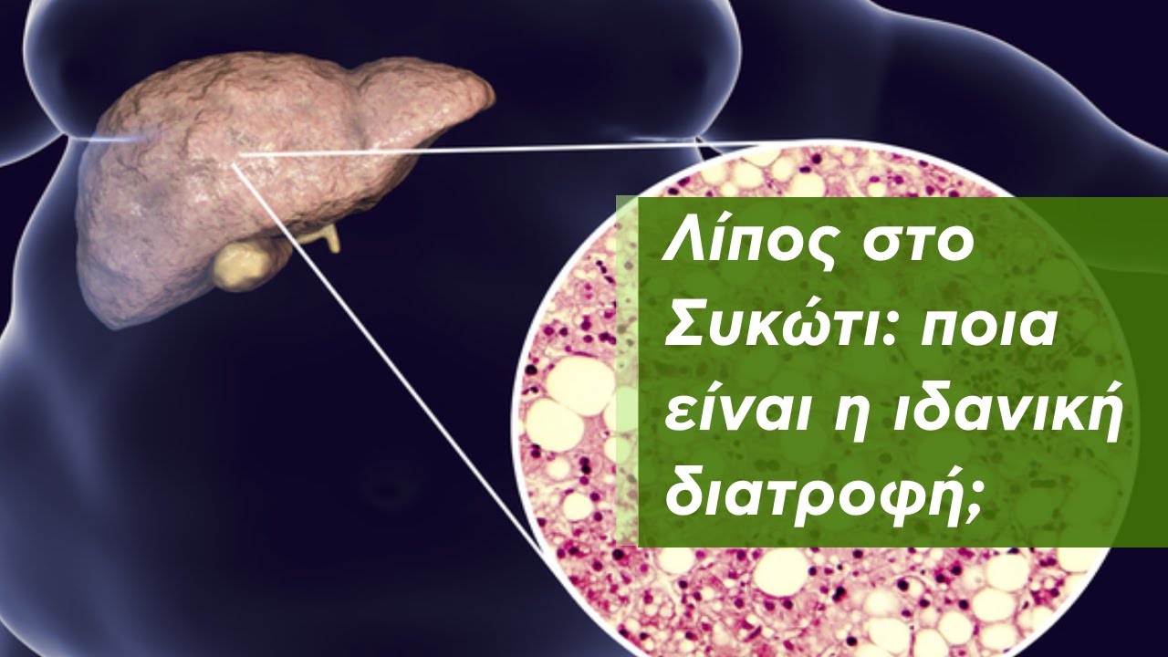 Λίπος στο Συκώτι: Ιδανική Διατροφή