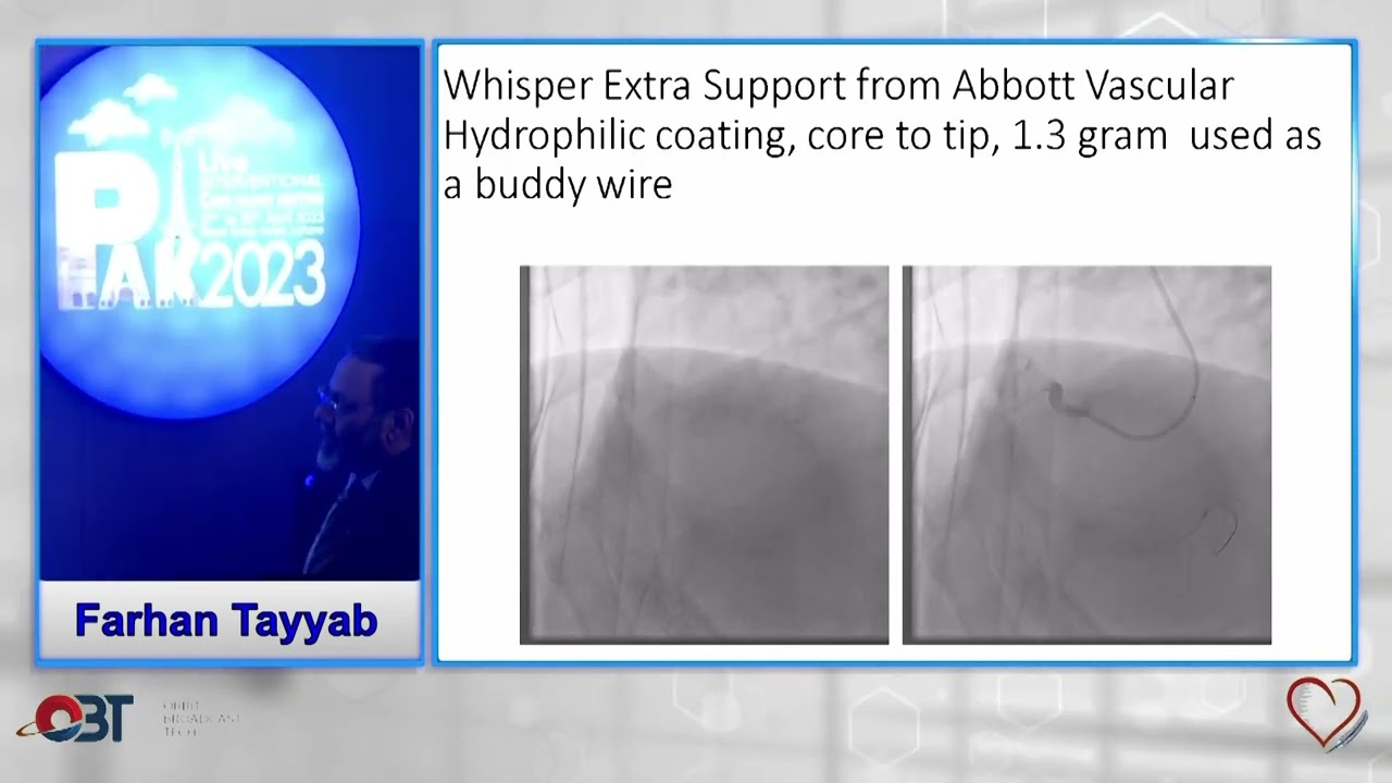 Coronary Guidewire Workhorse to Specialty Choices by Farhan Tayyab