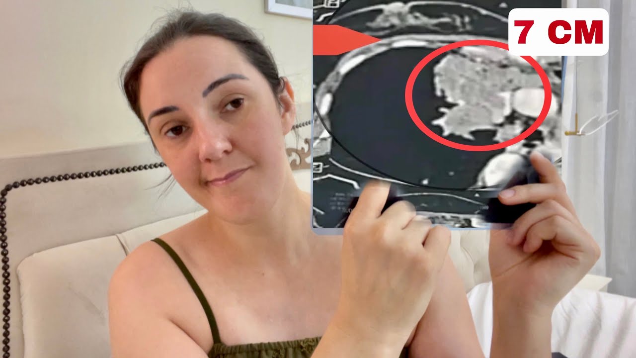 ESTOU COM SUSPEITA DE UM TUMOR NO MEDIASTINO ( ENTRE OS DOIS PULMÃO E CORAÇÃO ) Minha vida virou …