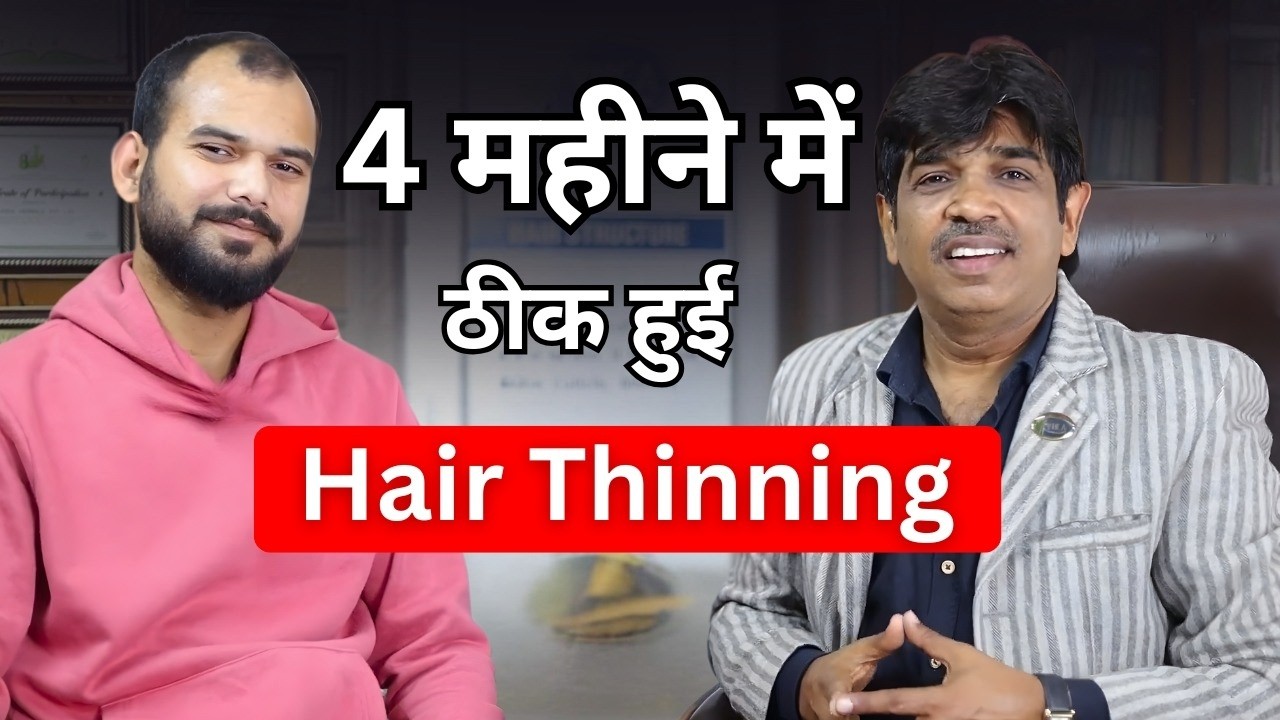 From Thinning Hairline to Thicker Hair | Real Patient Result at VHCA | 4 Month Transformation Story