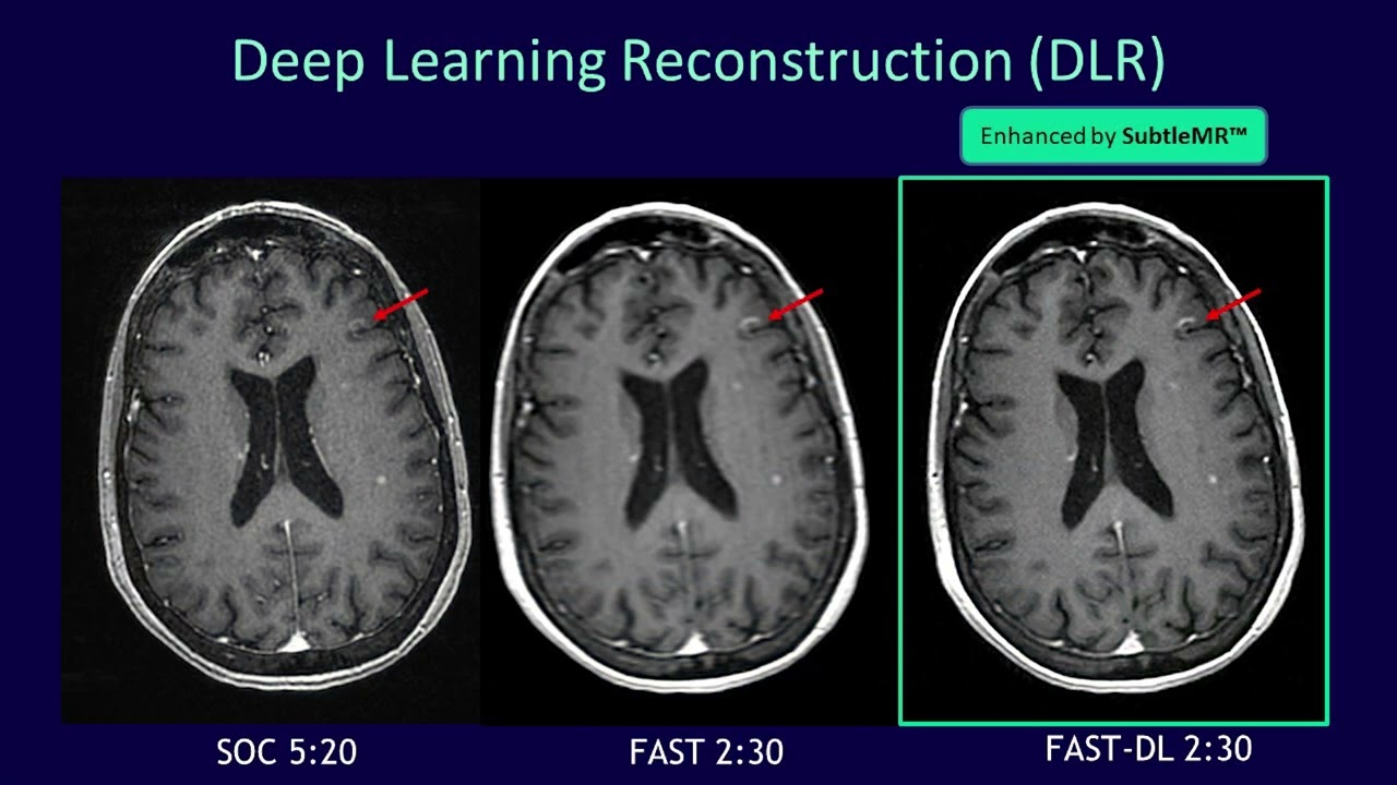 RSNA 2022 - AI Theater Presentation