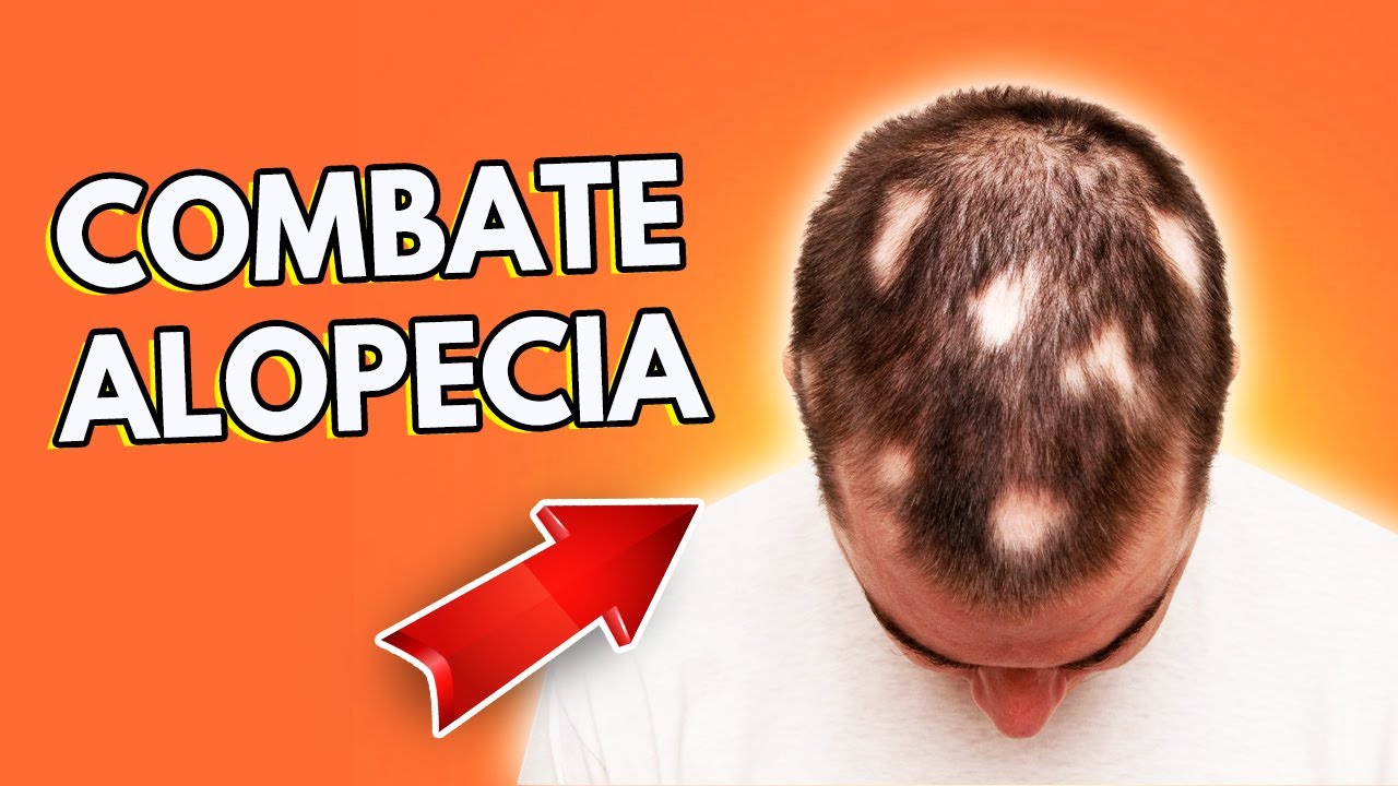 ERVA QUE COMBATE QUEDA DE CABELO E FALTA DE VOLUME CAPILAR | Peter Liu