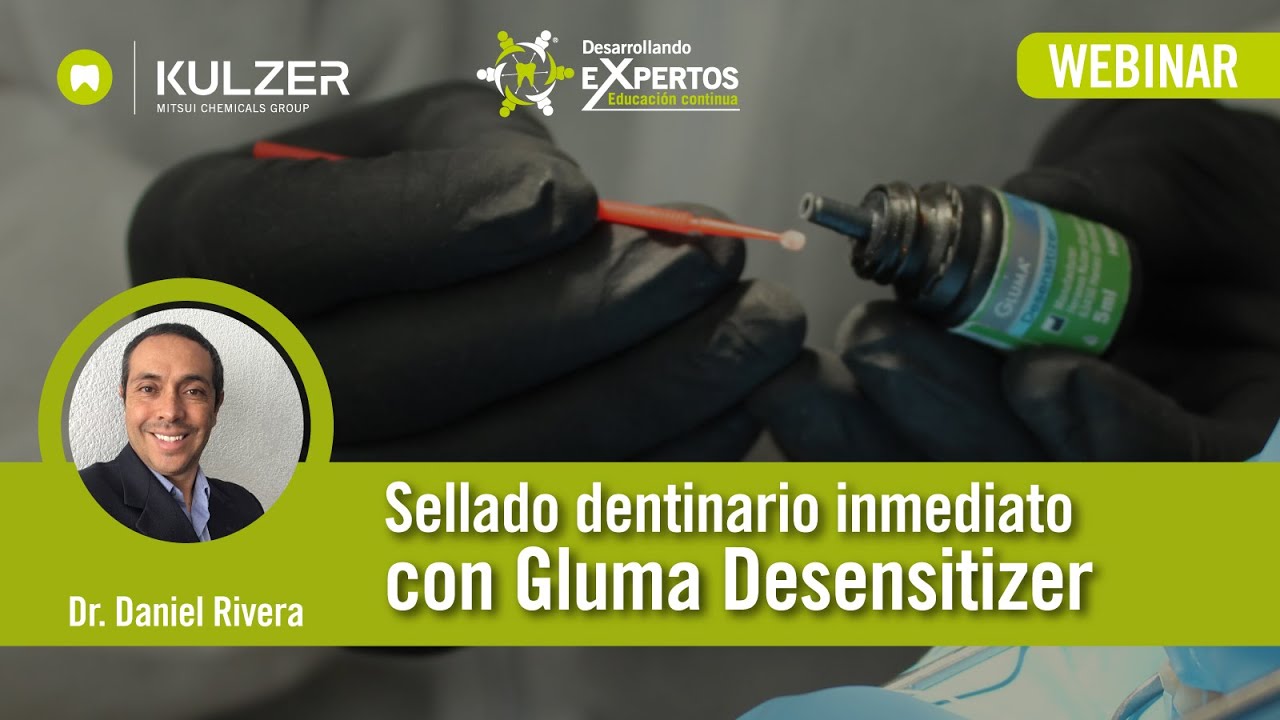 Desarrollando eXpertos - Sellado dentinario inmediato con Gluma Desensitizer