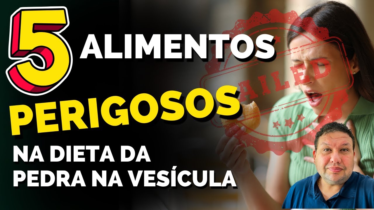 5 ALIMENTOS QUE CAUSAM DOR DE PEDRA NA VESÍCULA E VOCÊ NÃO SABE !!