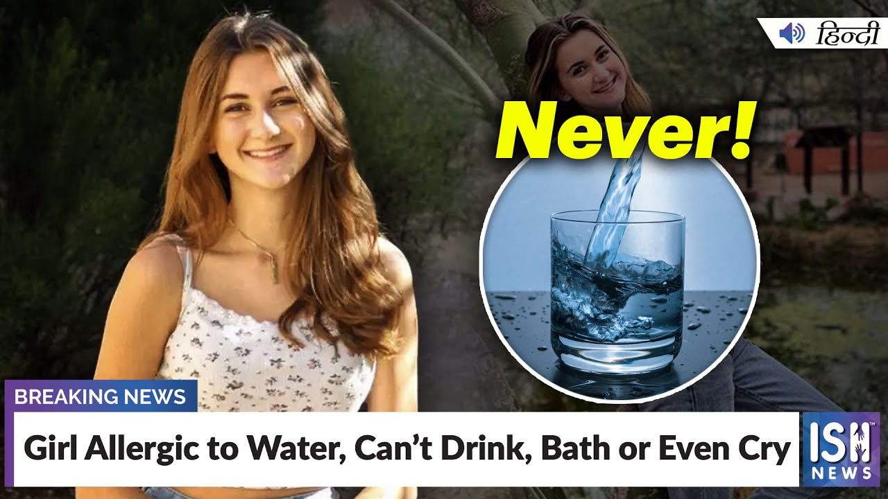 Girl Allergic to Water, Can’t Drink, Bath or Even Cry | ISH News