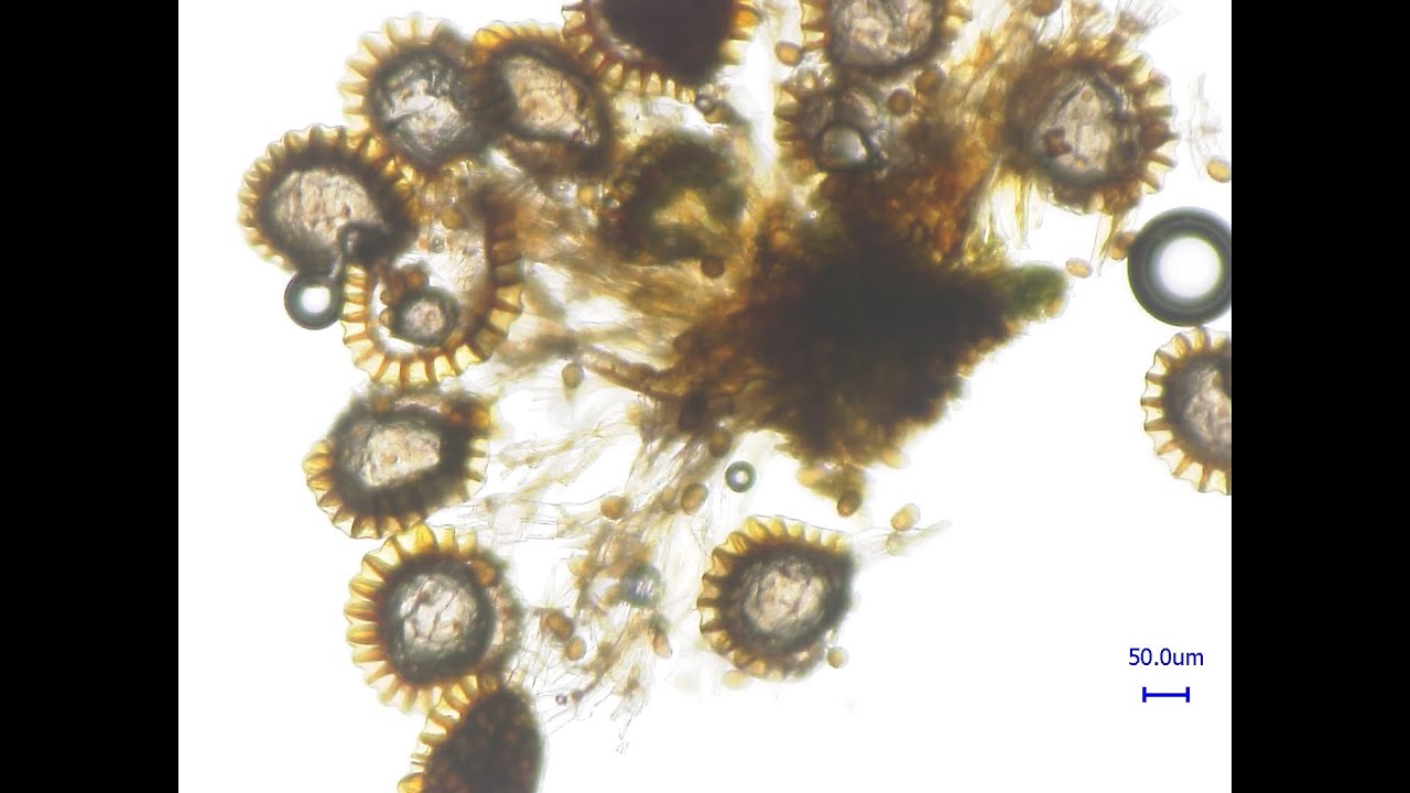 Farne- Kurze Übersicht Fortpflanzung und mikroskopische Details