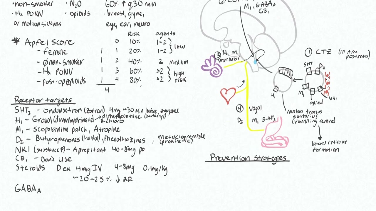 Postoperative Nausea and Vomiting 2 - Prophylaxis agents