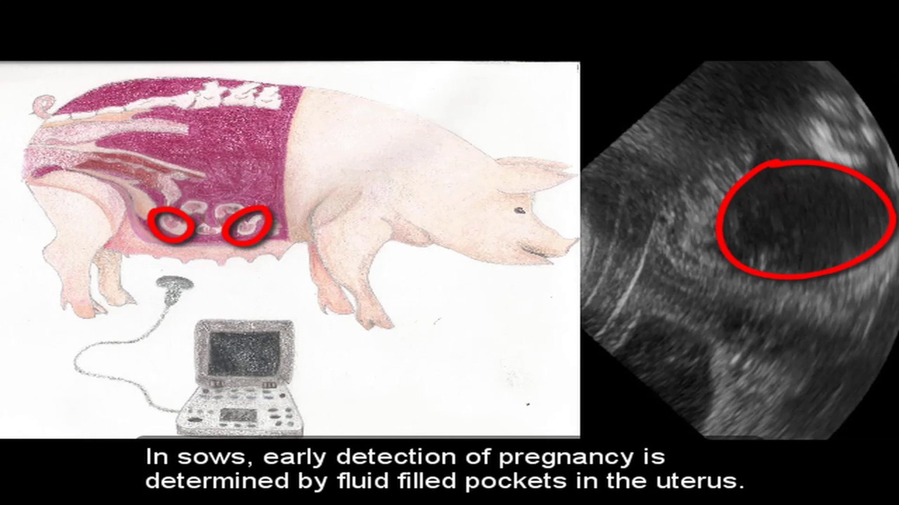 Ultrasounding for Pregnancy Detection