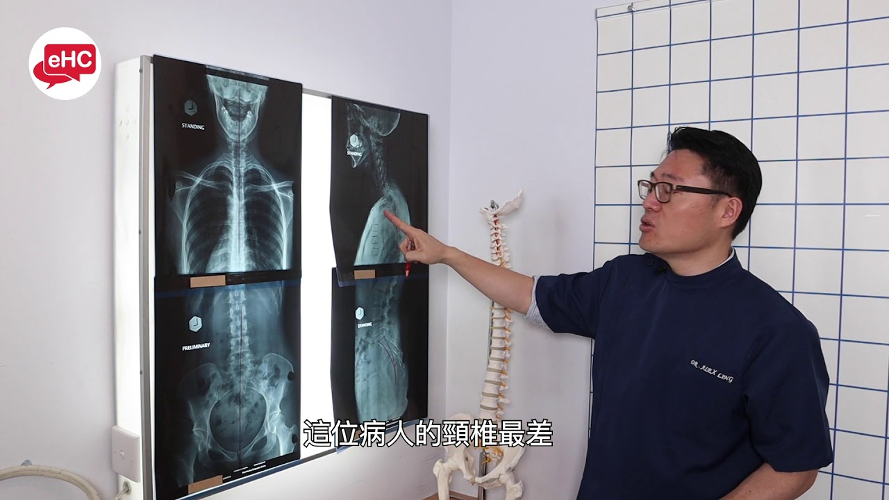 脊醫教你用X光片觀察脊椎問題