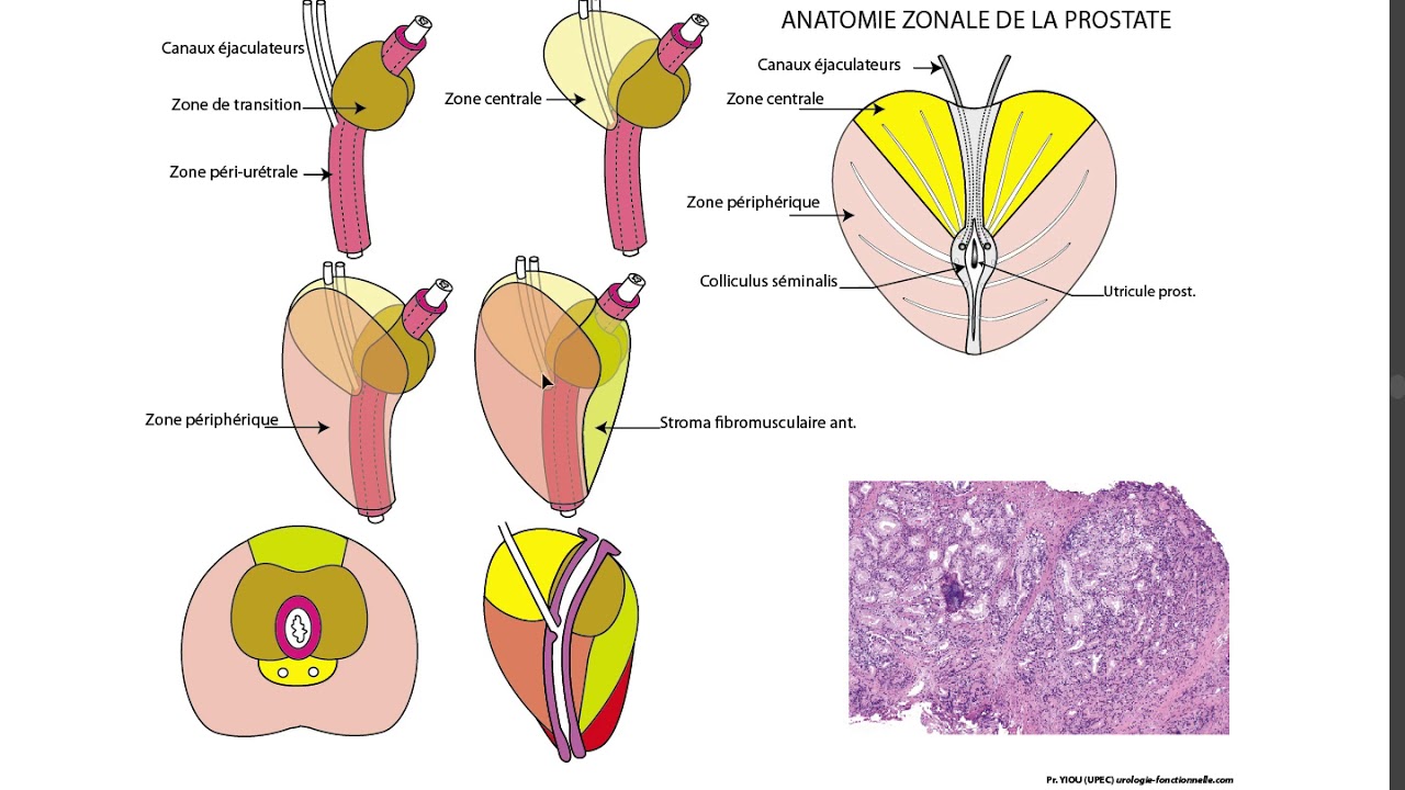 22 PROSTATE ANATOMIE ZONALE