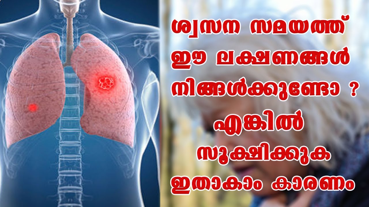 ശ്വസന  സമയത്ത് ഈ #ലക്ഷണങ്ങൾ നിങ്ങൾക്കുണ്ടോ എങ്കിൽ #സൂക്ഷിക്കുക ഇതാകാം കാരണം #DrPraveen