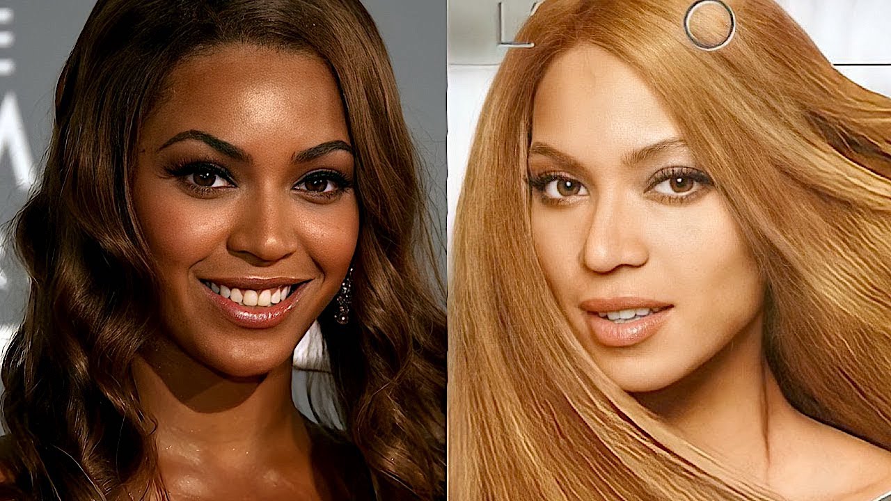 Why are we taught to dislike dark skin?