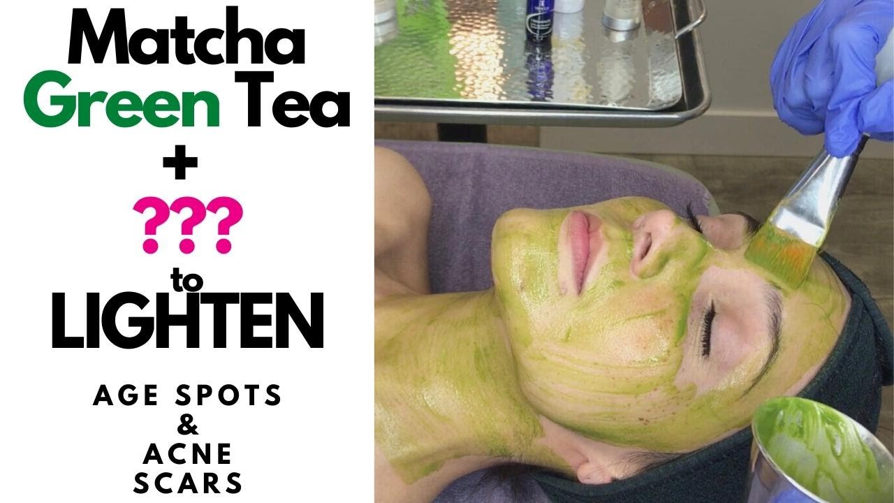 Matcha Green Tea Mask for Hyperpigmentation and Acne Scars #matcha