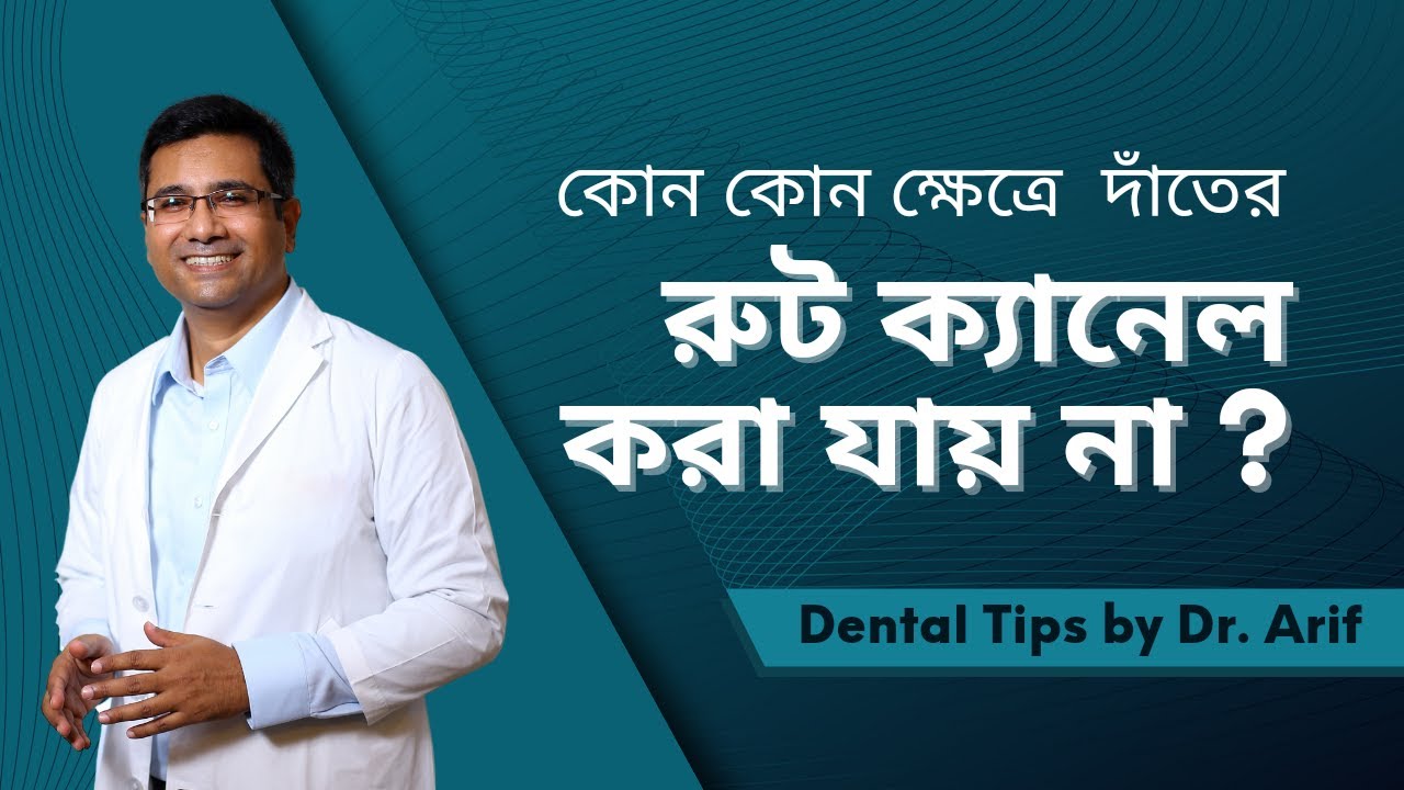 রুট ক্যানেল কোন ক্ষেত্রে করা যায় না | When Root Canal can not be done
