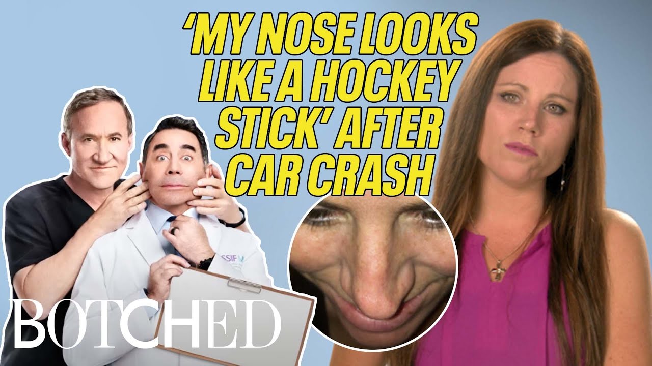 Christina's MAJOR Car Crash Left Her Nose CROOKED (Before & After) | Botched | E!