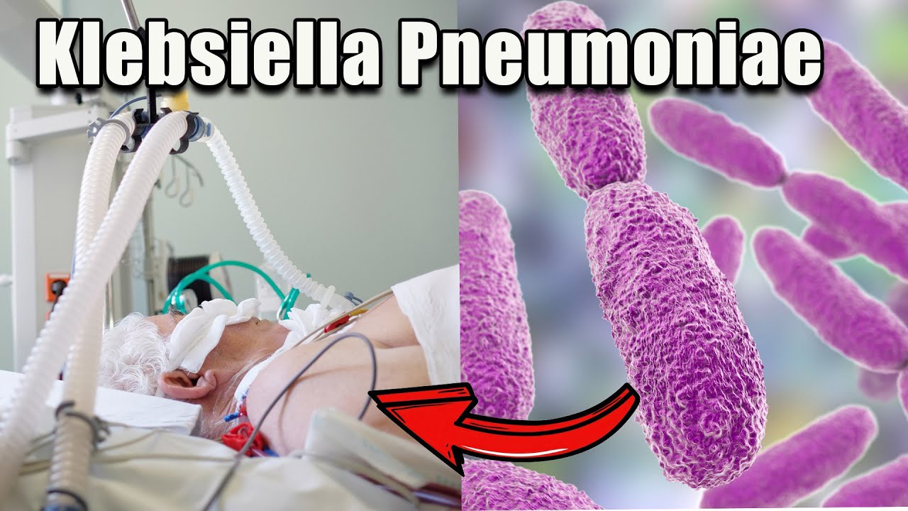 The (almost) Untreatable Infection: Klebsiella pneumoniae carbapenimase (KPC)