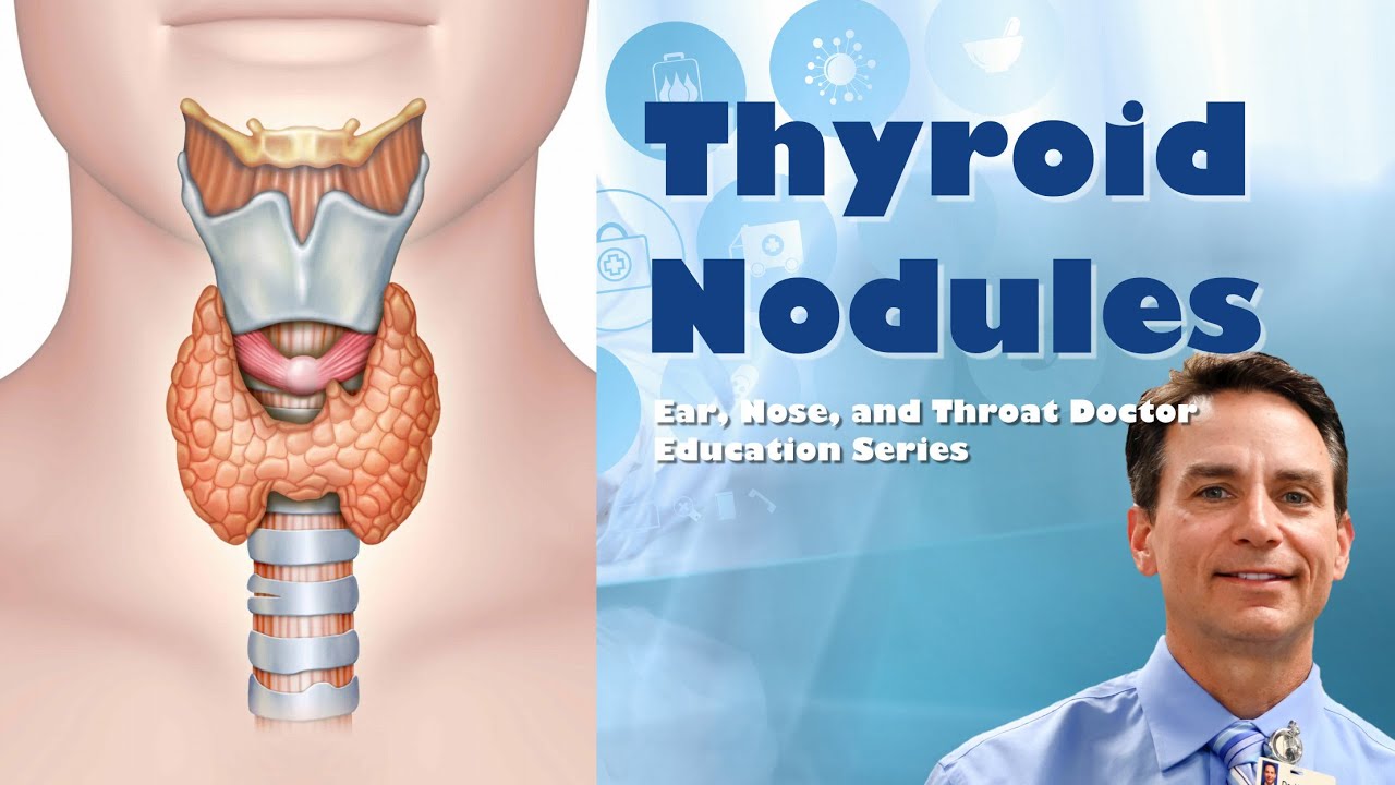 Thyroid Nodules