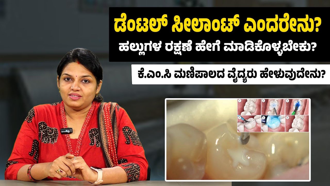 ಹಲ್ಲುಗಳ ರಕ್ಷಣೆ ಹೇಗೆ ಮಾಡಿಕೊಳ್ಳಬೇಕು? | Dental sealant |  How To Keep Your Teeth Healthy And Strong |Uv