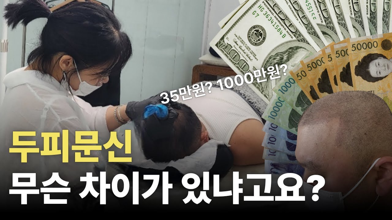 두피문신 가격, 효과, 유지기간까지 현실적으로 다 알려드립니다