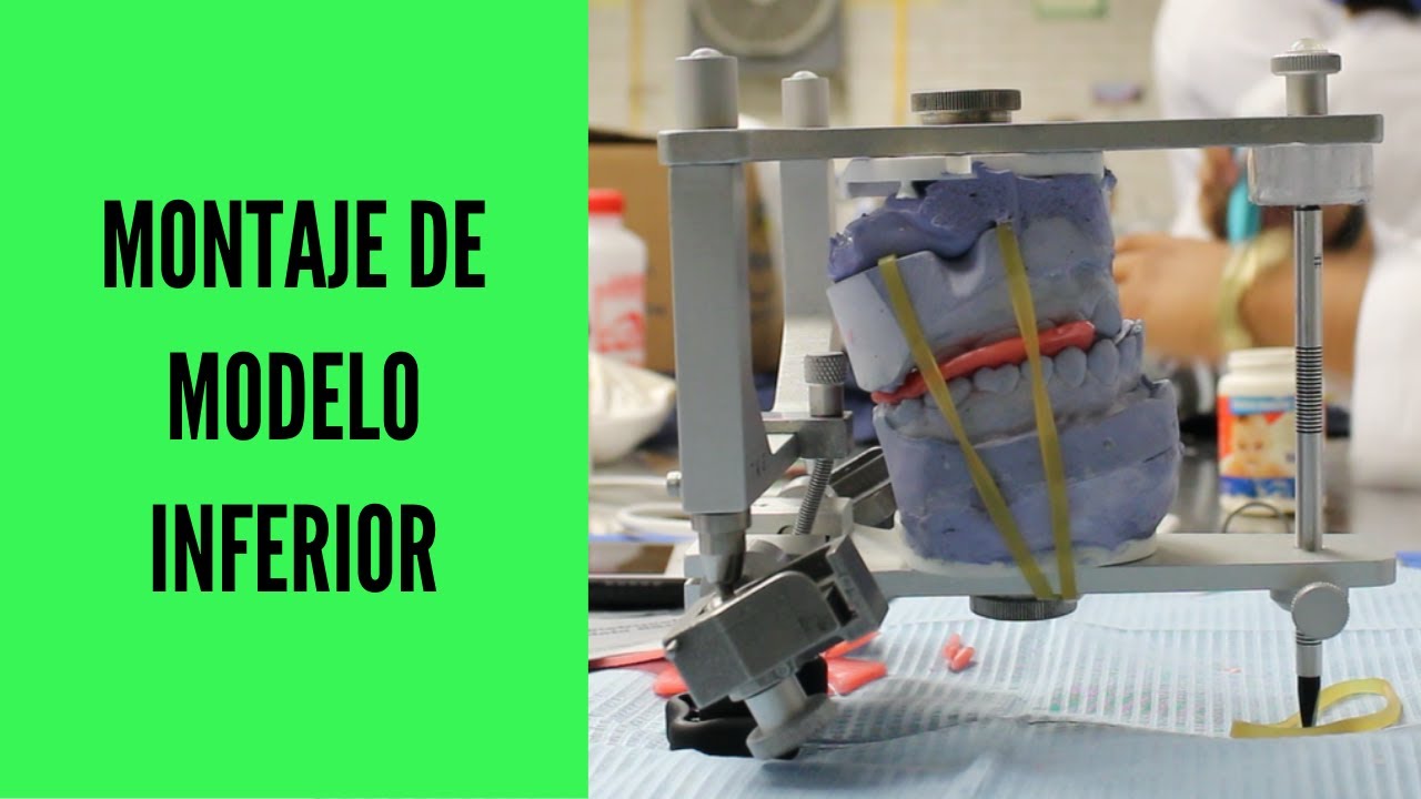 ✅Montaje de MODELO INFERIOR🦷/Montaje en articulador semiajustable Whip Mix 8500‼️ 2020