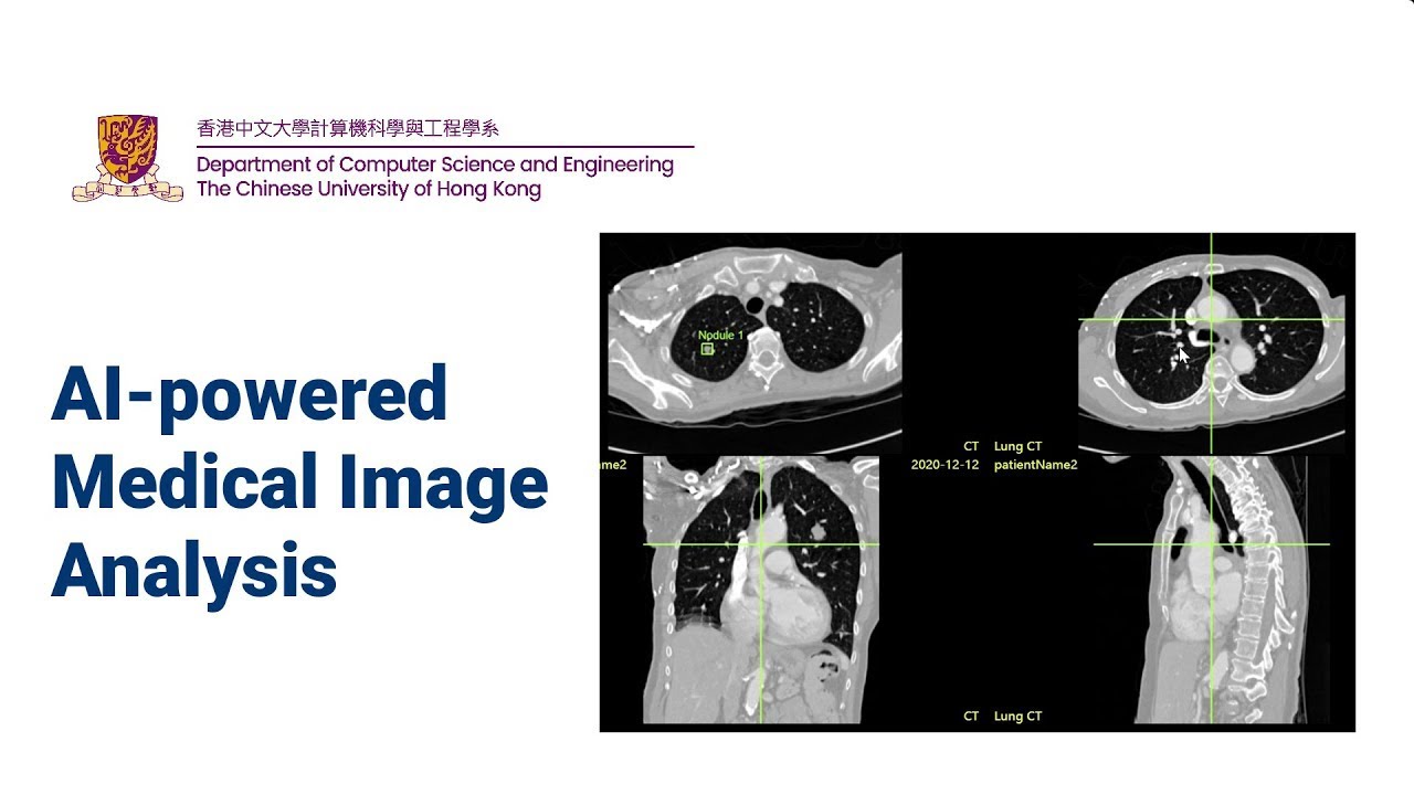 AI-powered Medical Image Analysis
