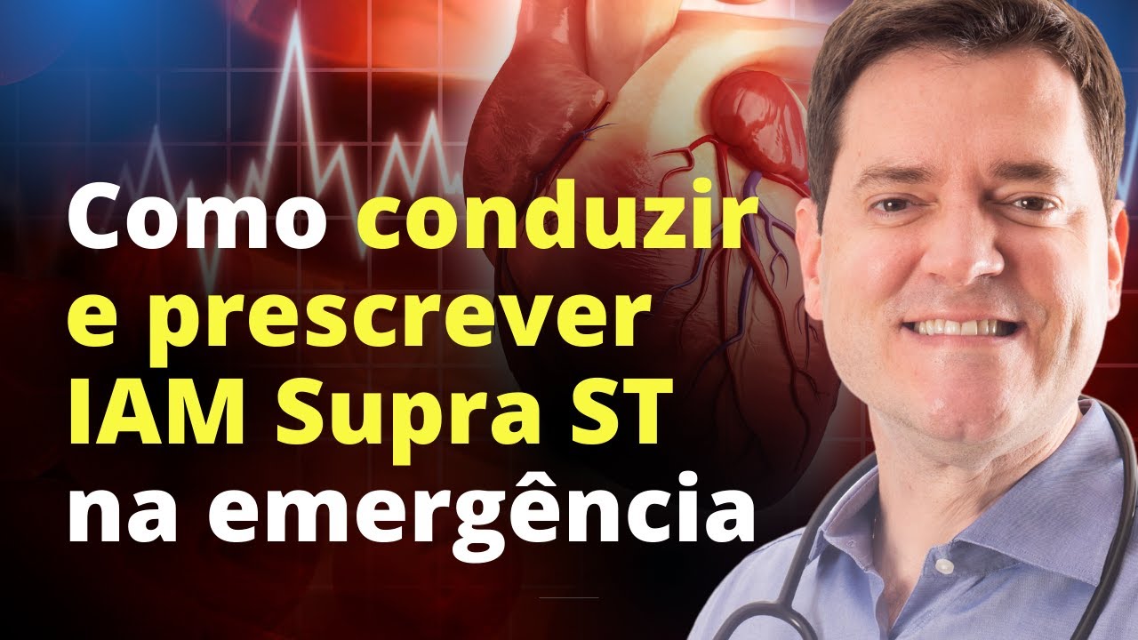 COMO CONDUZIR E PRESCREVER IAM COM SUPRA DE ST NA EMERGÊNCIA