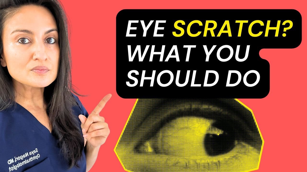 OUCH! Eye Doctor Explains What to Do for Eye Scratch | Corneal abrasion care guide