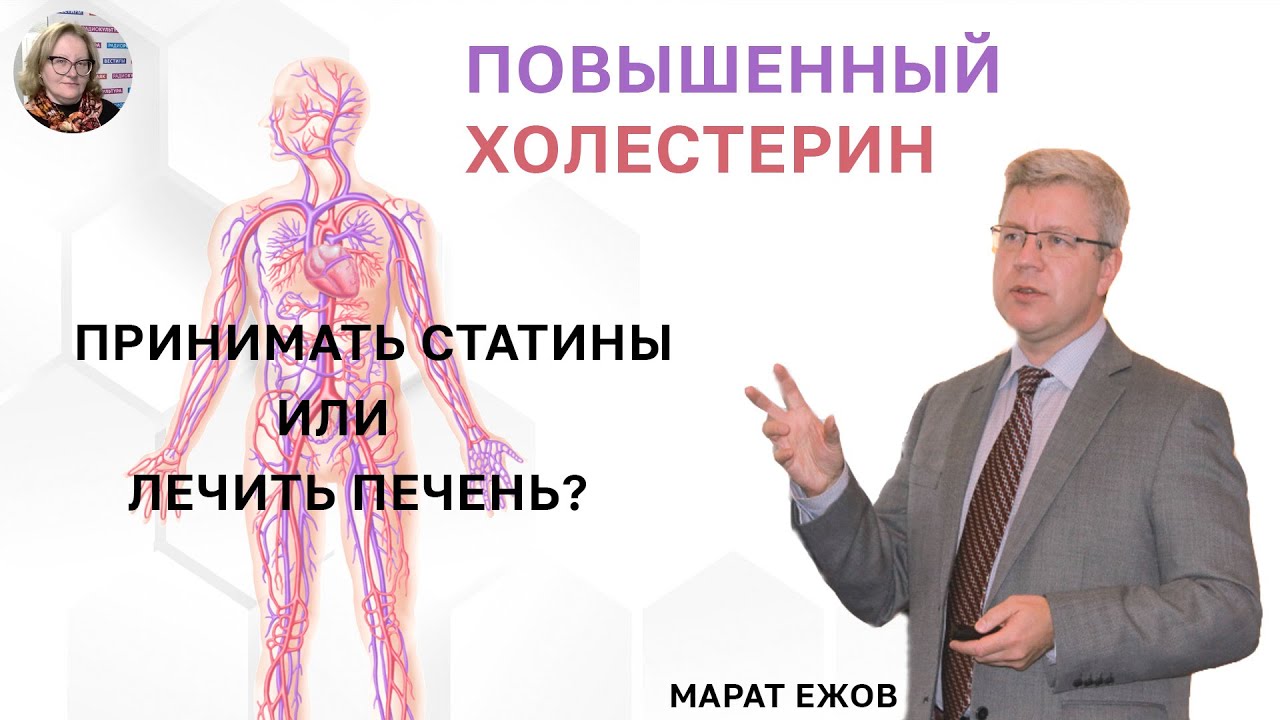 В гостях у Ольги Копыловой Марат Ежов–д.м.н., проф., президент Национального общества атеросклероза