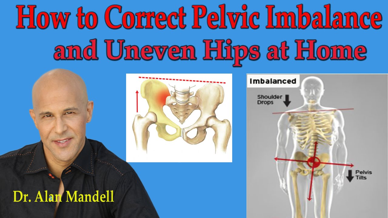 How To Correct Pelvic Imbalance and Uneven Hips at Home - Dr Mandell