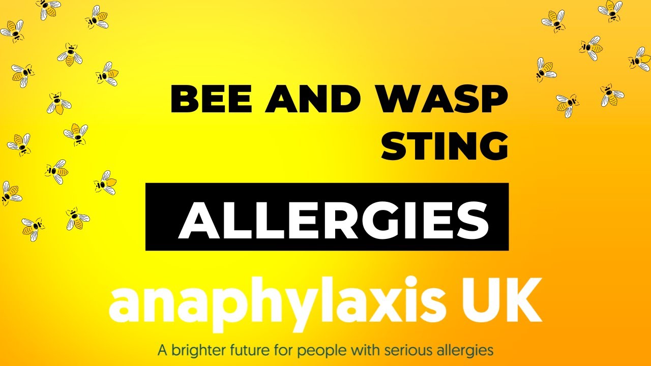 Allergies to Bee & Wasp Stings