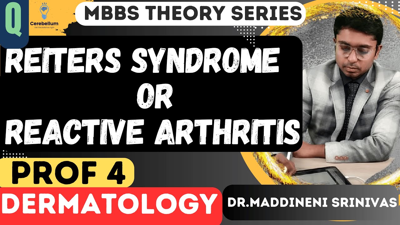Reiters syndrome | REACTIVE ARTHRITIS | Dermatology for 4th year MBBS |