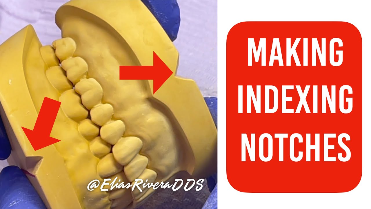 Preparing Cast for Mounting:  Making Indexing Notches - 4k