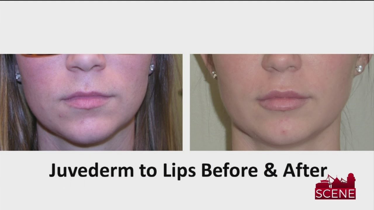 How to Get Bigger Lips and Tighter Skin