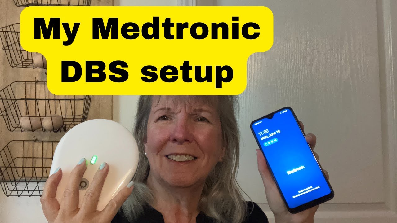 My Deep Brain Stimulation Setup