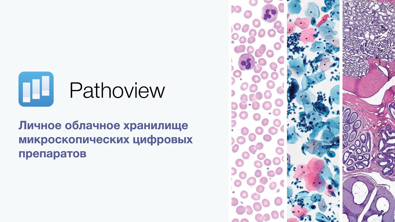 Личное облачное хранилище микроскопических цифровых препаратов | Pathoview