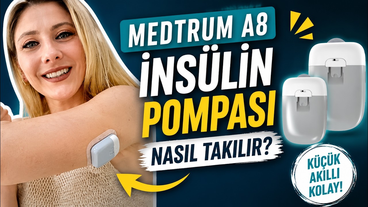 Medtrum A8 İnsülin Pompası: Akıllı Teknolojiyle Şeker Kontrolü