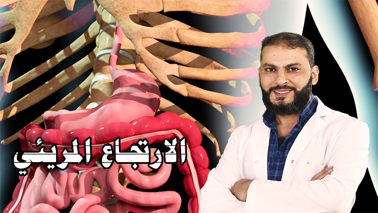 الارتجاع المريئي وكيفية علاجه واحذر مما يقولون عنه