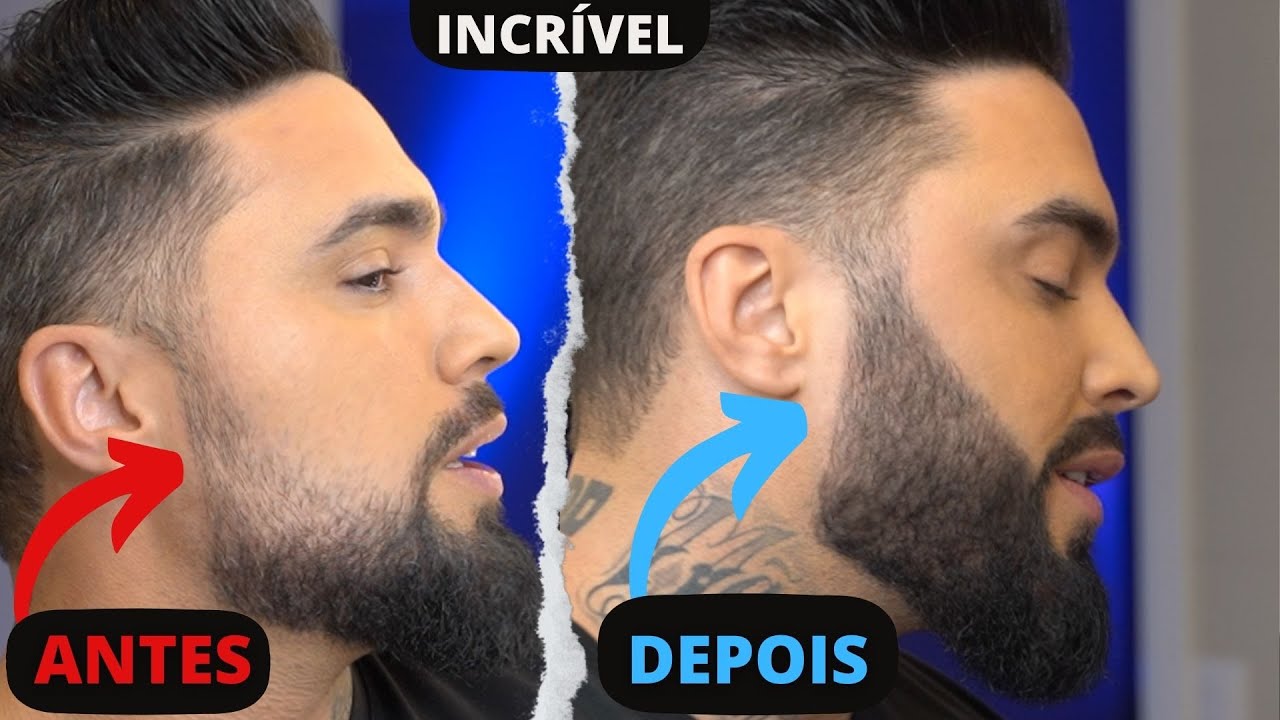 COMO PREENCHER AS FALHAS NA BARBA COM PREENCHEDOR (NOVIDADE)