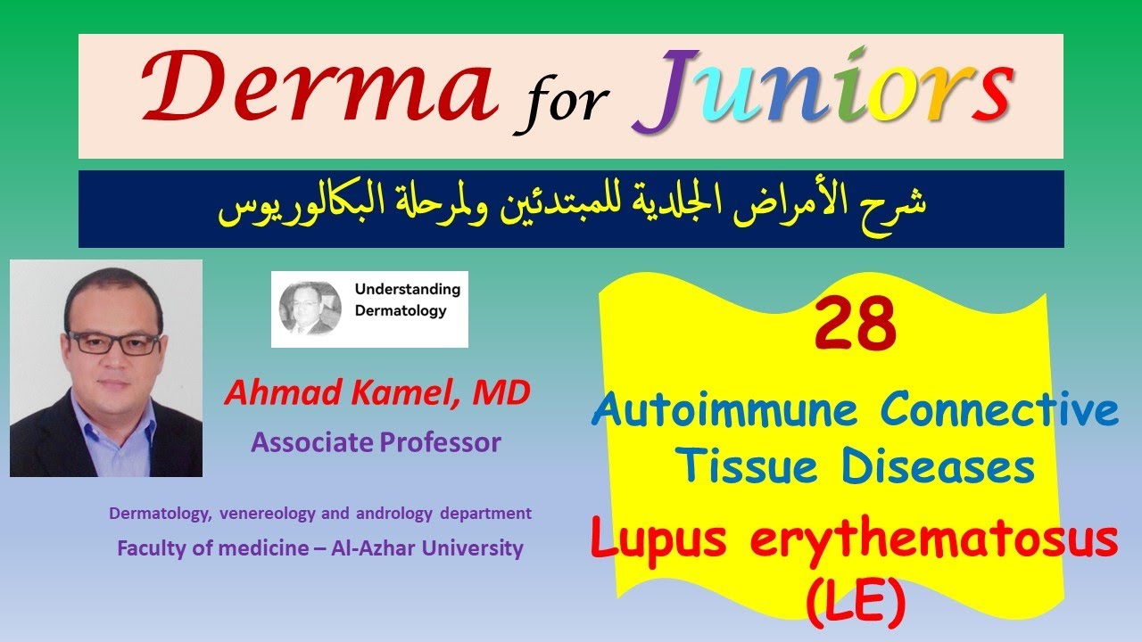 028 Lupus Erythematosus LE Autoimmune Connective tissue diseases