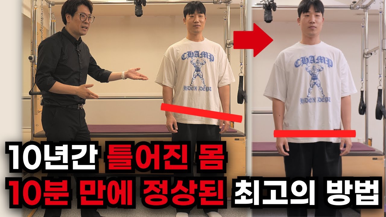 야구선수 출신 트레이너도 놀란 체형교정 방법 10년간 꼬여있었던 몸을 바른몸으로 만들었습니다