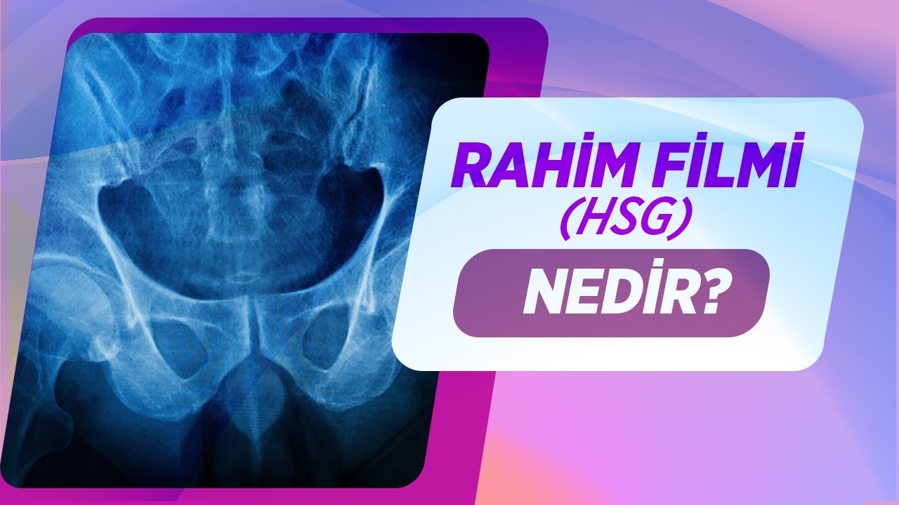 Rahim Filmi Nedir? Rahim Filmi Sonrası Enfeksiyon Olur Mu? - Dr. Nermin Köşüş