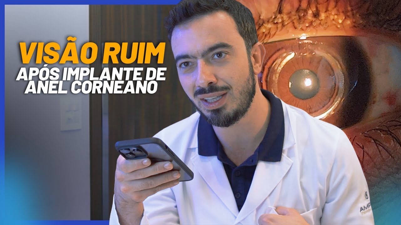 Implante de Anel Corneano: Realidade Após a Cirurgia