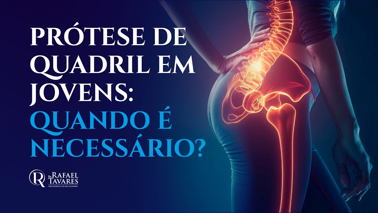 PRÓTESE DE QUADRIL EM JOVENS: QUANDO É NECESSÁRIO? | Dr Rafael Tavares - Quadril