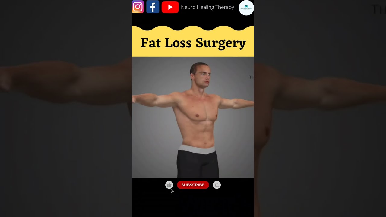 weight loss fat loss surgery #viral