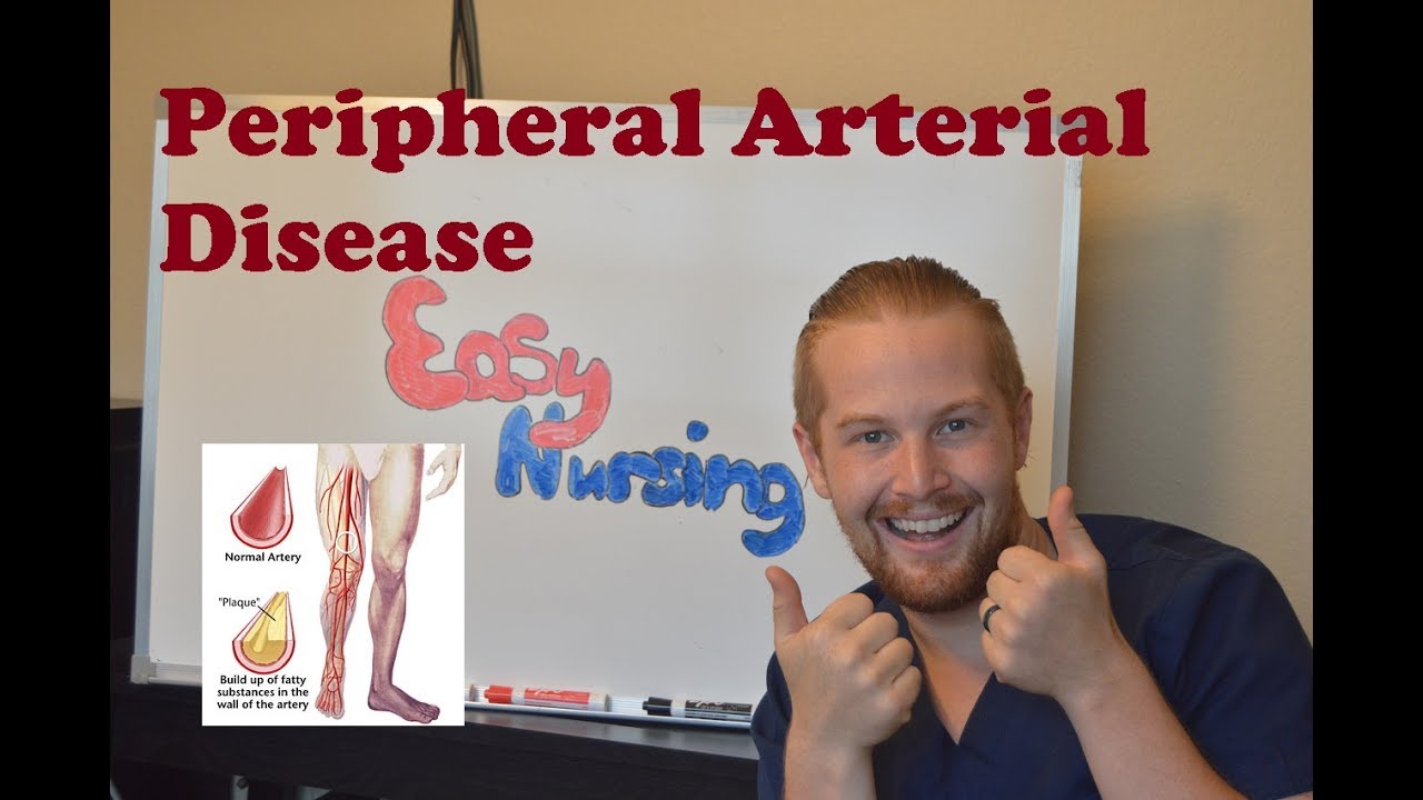 Peripheral Arterial Disease (PAD) - NCLEX Review