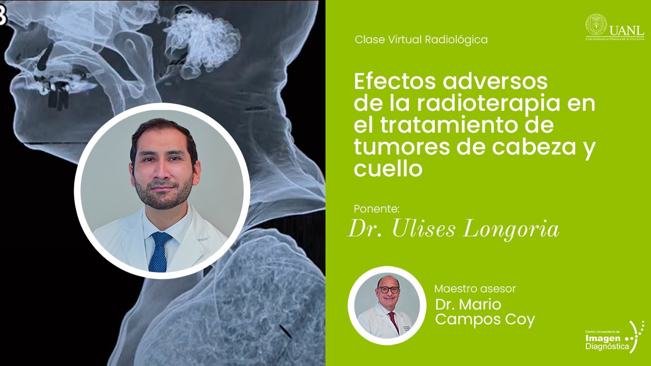 Efectos adversos de la radioterapia en el tratamiento de tumores de cabeza y cuello.